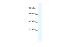 Aviva Systems Biology Corp ZBTB7C Antibody - N-terminal region (ARP32872_T100)