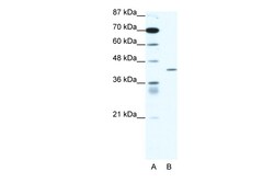 Aviva Systems Biology Corp PPARD Antibody - middle region (ARP32878_T100)