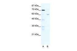 Aviva Systems Biology Corp FOXJ2 Antibody - N-terminal region (ARP32909_T100)
