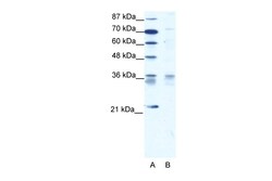 Aviva Systems Biology Corp BARX1 Antibody - middle region (ARP32920_T100)