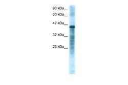 Aviva Systems Biology Corp PSMC3 Antibody - middle region (ARP32929_T100)