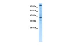 Aviva Systems Biology Corp ZNF624 Antibody - middle region (ARP32956_P050)