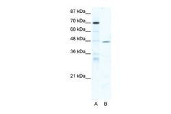 Aviva Systems Biology Corp NR2F6 Antibody - middle region (ARP32995_T100)