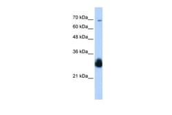 Aviva Systems Biology Corp RNF138 Antibody - C-terminal region (ARP33005_P050)