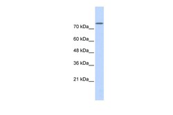 Aviva Systems Biology Corp PLD2 Antibody - middle region (ARP33044_P050)