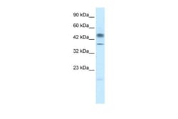 Aviva Systems Biology Corp POU3F1 Antibody - N-terminal region (ARP33061_T100)