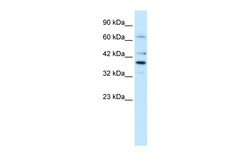 Aviva Systems Biology Corp POU4F3 Antibody - middle region (ARP33065_T100)