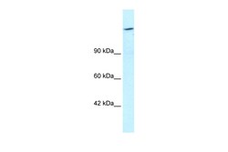 Aviva Systems Biology Corp ARID4A Antibody - C-terminal region (ARP33088_T100)