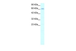 Aviva Systems Biology Corp IVNS1ABP Antibody - N-terminal region (ARP33100_T100)
