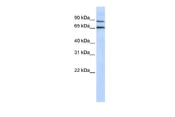 Aviva Systems Biology Corp GPR75 Antibody - middle region (ARP33103_P050)