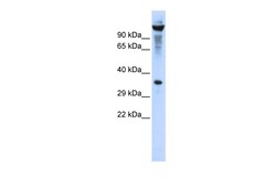 Aviva Systems Biology Corp RNASET2 Antibody - middle region (ARP33127_P050)