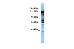 Aviva Systems Biology Corp CASZ1 Antibody - middle region (ARP33139_P050)