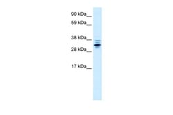 Aviva Systems Biology Corp ZNF654 Antibody - middle region (ARP33144_P050)