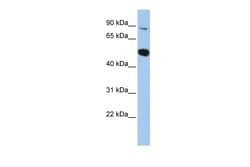 Aviva Systems Biology Corp SOX6 Antibody - middle region (ARP33148_P050)