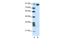 Aviva Systems Biology Corp MYNN Antibody - middle region (ARP33160_T100)