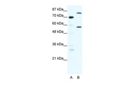 Aviva Systems Biology Corp MYNN Antibody - middle region (ARP33161_T100)