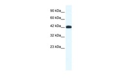 Aviva Systems Biology Corp SLC2A4RG Antibody - middle region (ARP33168_P050)