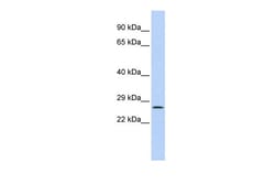Aviva Systems Biology Corp GATAD1 Antibody - middle region (ARP33194_P050)