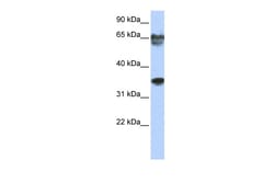 Aviva Systems Biology Corp NKX3-2 Antibody - N-terminal region (ARP33199_P050)
