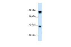 Aviva Systems Biology Corp RB1 Antibody - C-terminal region (ARP33212_P050)
