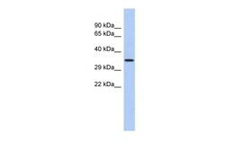 Aviva Systems Biology Corp PRDM12 Antibody - N-terminal region (ARP33218_P050)