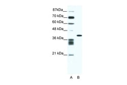 Aviva Systems Biology Corp ALX4 Antibody - N-terminal region (ARP33240_P050)
