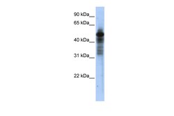 Aviva Systems Biology Corp RORC Antibody - middle region (ARP33243_P050)