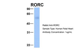 Aviva Systems Biology Corp RORC Antibody - C-terminal region (ARP33244_P050)