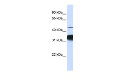 Aviva Systems Biology Corp RXRA Antibody - C-terminal region (ARP33248_P050)