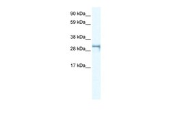 Aviva Systems Biology Corp SHOX2 Antibody - middle region (ARP33286_P050)