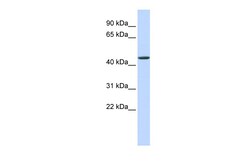 Aviva Systems Biology Corp JMJD4 Antibody - N-terminal region (ARP33301_P050)