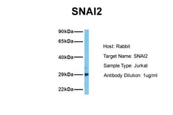 Aviva Systems Biology Corp SNAI2 Antibody - middle region (ARP33302_P050)