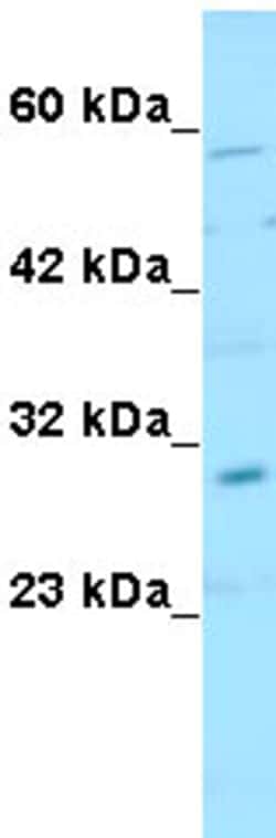 Aviva Systems Biology Corp SNAI1 Antibody - N-terminal region (ARP33314_P050)