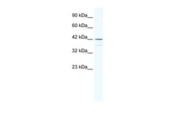 Aviva Systems Biology Corp SOX3 Antibody - N-terminal region (ARP33321_P050)