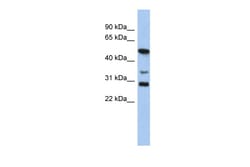 Aviva Systems Biology Corp SOX3 Antibody - middle region (ARP33322_P050)