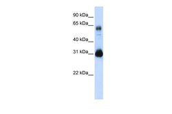 Aviva Systems Biology Corp SOX15 Antibody - middle region (ARP33329_P050)