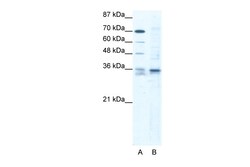 Aviva Systems Biology Corp SOX12 Antibody - C-terminal region (ARP33330_T100)
