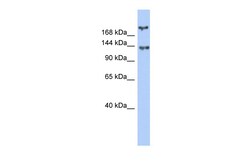 Aviva Systems Biology Corp BRCA1 Antibody - middle region (ARP33338_P050)