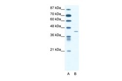 Aviva Systems Biology Corp SSTR4 Antibody - middle region (ARP33359_T100)