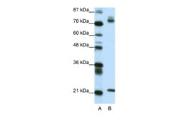 Aviva Systems Biology Corp SATB1 Antibody - C-terminal region (ARP33362_P050)
