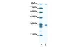 Aviva Systems Biology Corp PKNOX2 Antibody - N-terminal region (ARP33366_T100)