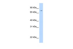 Aviva Systems Biology Corp STAT1 Antibody - N-terminal region (ARP33373_P050)