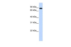 Aviva Systems Biology Corp STAT5B Antibody - N-terminal region (ARP33379_P050)
