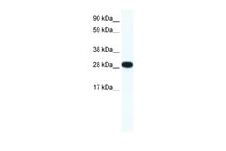 Aviva Systems Biology Corp ZFP36L1 Antibody - N-terminal region (ARP33381_P050)