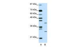 Aviva Systems Biology Corp ZFP36L1 Antibody - N-terminal region (ARP33381_T100)