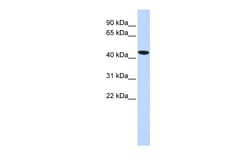 Aviva Systems Biology Corp TBX1 Antibody - middle region (ARP33398_P050)