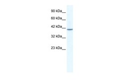 Aviva Systems Biology Corp TBX1 Antibody - C-terminal region (ARP33399_T100)