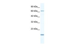 Aviva Systems Biology Corp TBX5 Antibody - N-terminal region (ARP33403_P050)