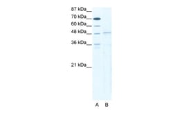 Aviva Systems Biology Corp TBX5 Antibody - N-terminal region (ARP33403_T100)