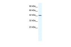 Aviva Systems Biology Corp TBX6 Antibody - N-terminal region (ARP33405_P050)